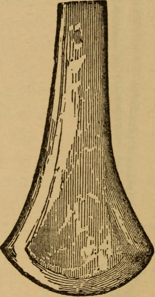 An illustration from Athletics and manly sport, 1890, leaf 205
