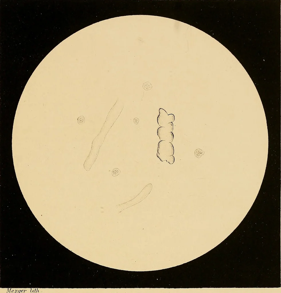 An illustration from An atlas of clinical microscopy, 1885, leaf 176