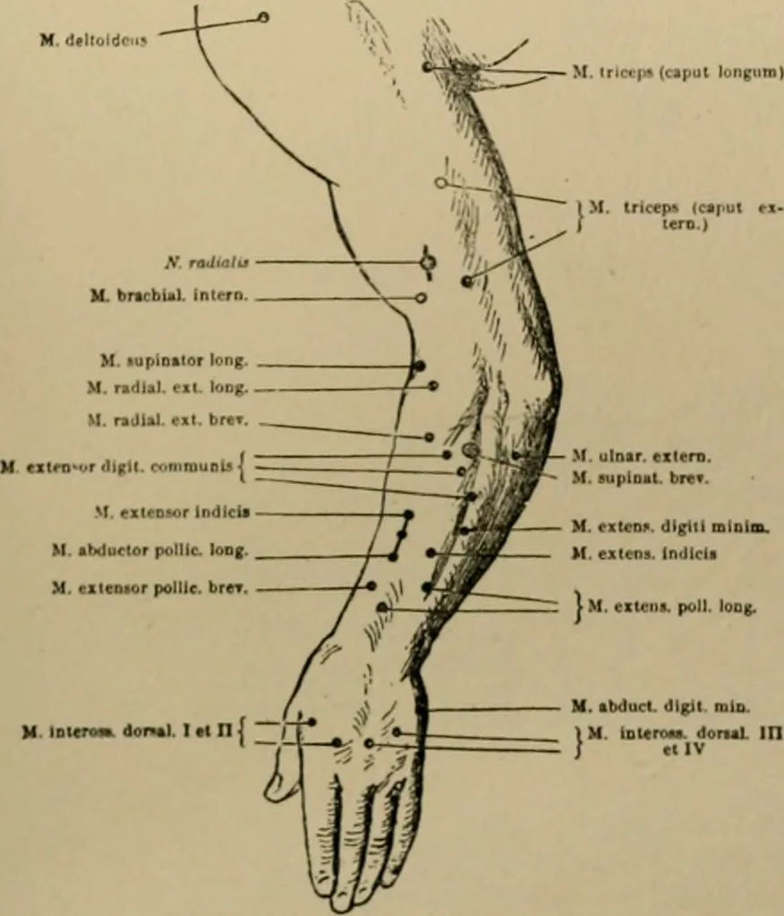 An illustration from An atlas of the differential diagnosis of the diseases of the nervous system; analytical and semeiological neurological charts, 1914, leaf 114