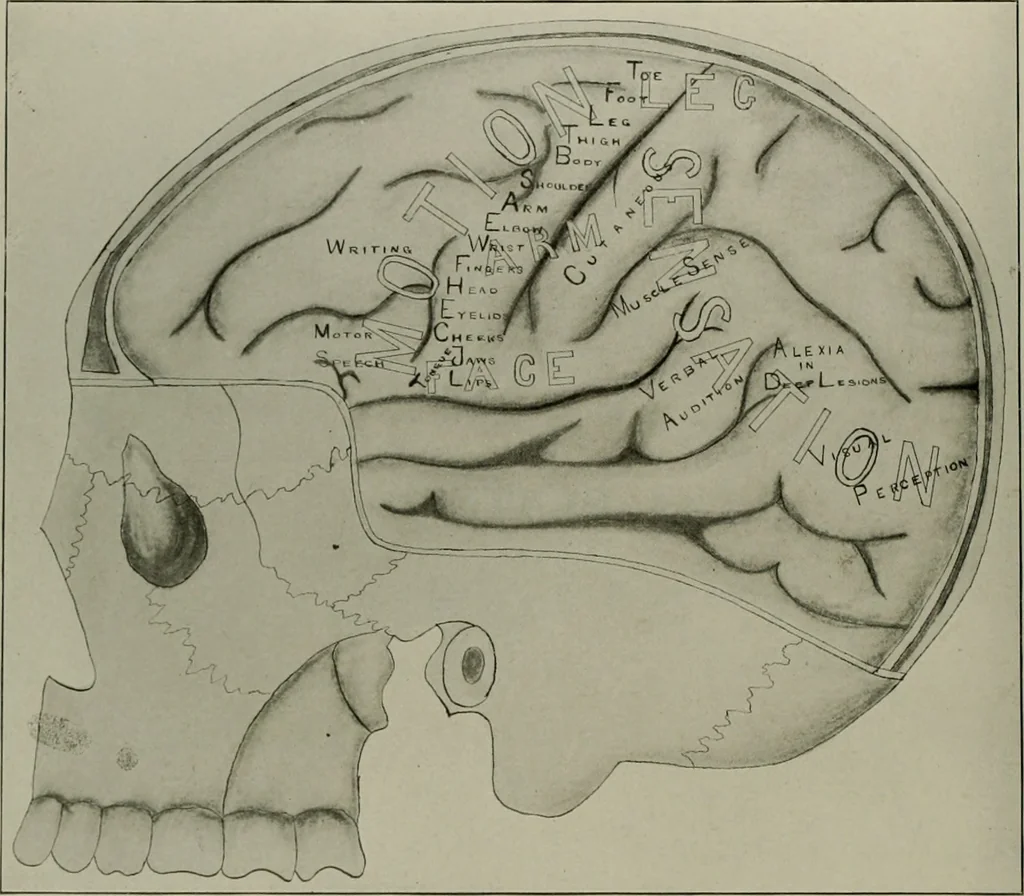 An illustration from An atlas of the differential diagnosis of the diseases of the nervous system; analytical and semeiological neurological charts, 1914, leaf 311