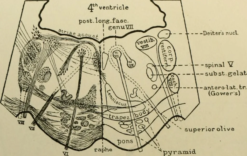 An illustration from An atlas of the differential diagnosis of the diseases of the nervous system; analytical and semeiological neurological charts, 1914, leaf 315