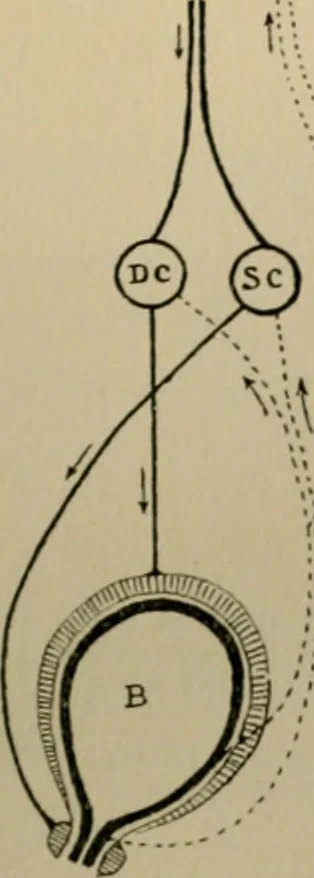 An illustration from An atlas of the differential diagnosis of the diseases of the nervous system; analytical and semeiological neurological charts, 1914, leaf 320