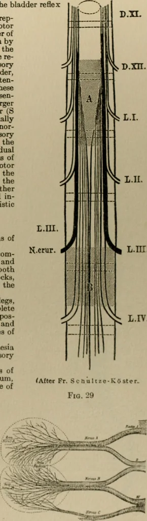 An illustration from An atlas of the differential diagnosis of the diseases of the nervous system; analytical and semeiological neurological charts, 1914, leaf 320