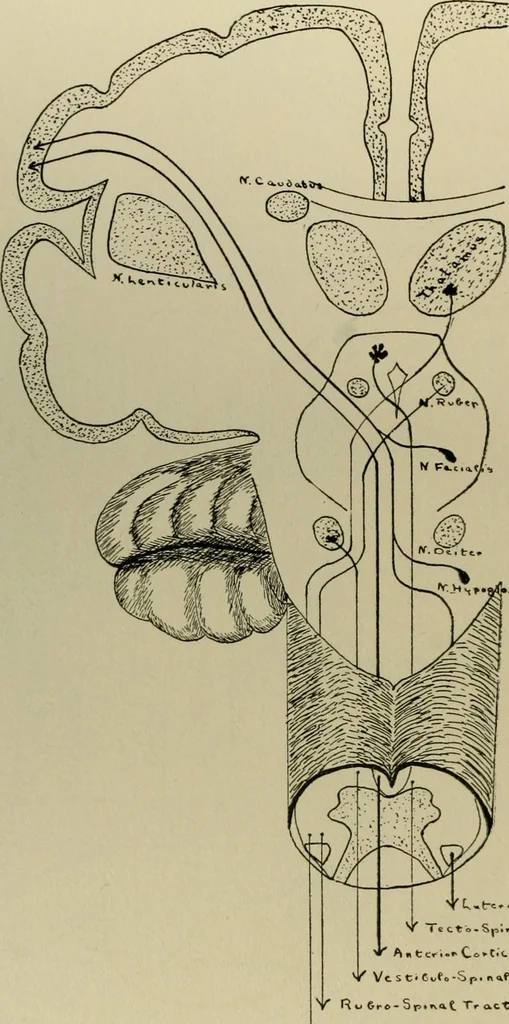 An illustration from An atlas of the differential diagnosis of the diseases of the nervous system; analytical and semeiological neurological charts, 1914, leaf 323