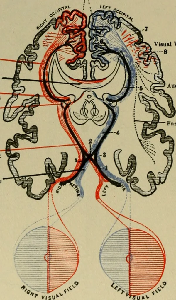 An illustration from An atlas of the differential diagnosis of the diseases of the nervous system; analytical and semeiological neurological charts, 1914, leaf 325
