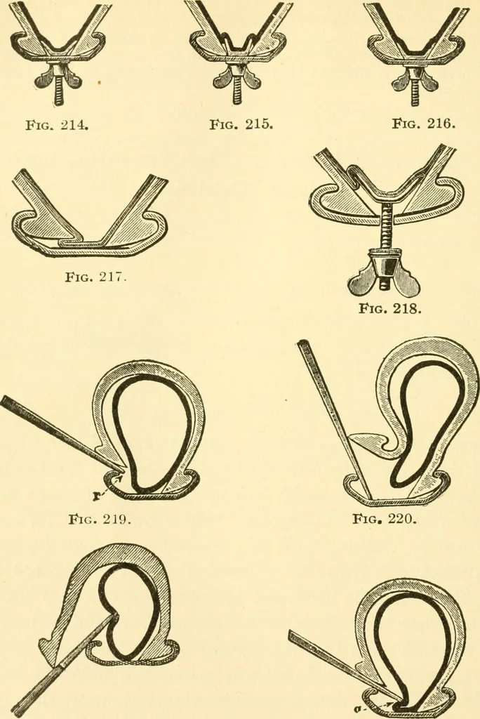 An illustration from Audels answers on automobiles, for owners, operators, repairmen ... including chapters on the storage battery, electric vehicles, motor cycles, overhauling the car, etc. Fully illustrated and indexed, 1911, leaf 351