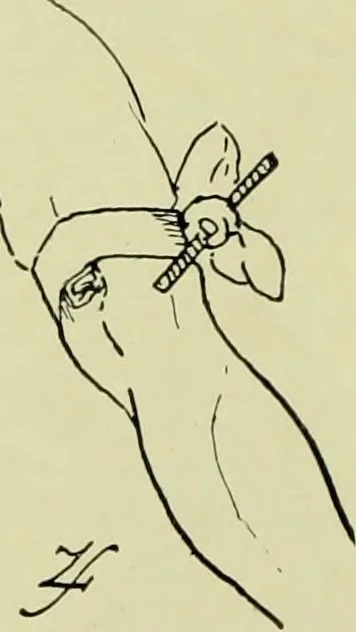 An illustration from Famous airmen and their equipment [electronic resource] : with some notes on first-aid in emergencies, 1912, leaf 69