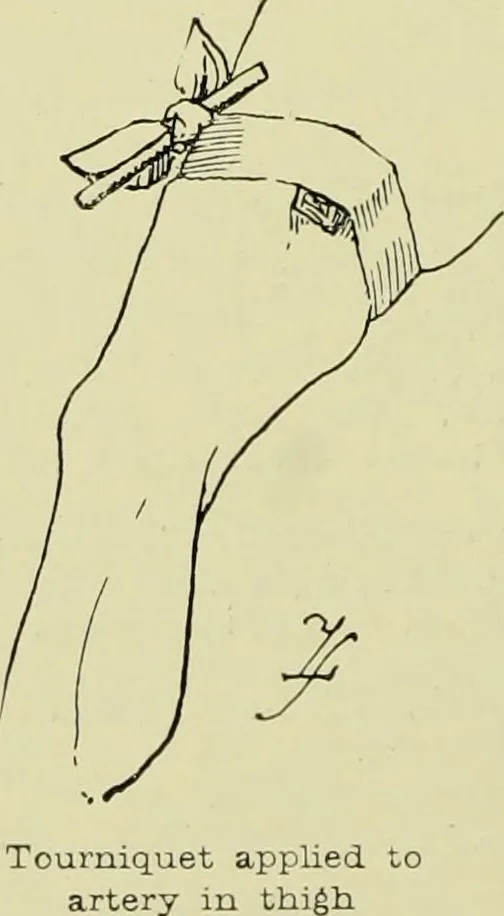 An illustration from Famous airmen and their equipment [electronic resource] : with some notes on first-aid in emergencies, 1912, leaf 69