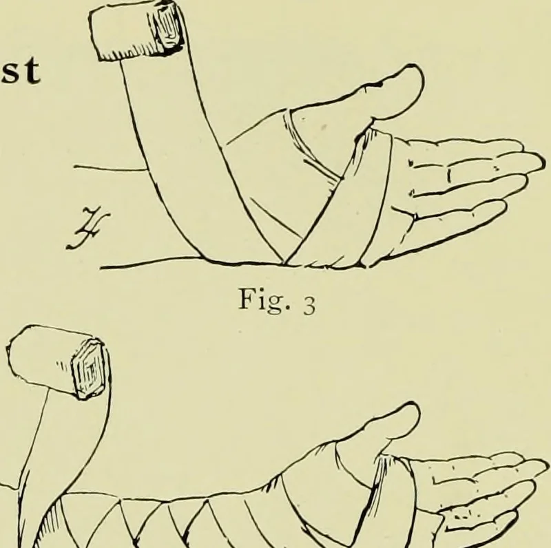 An illustration from Famous airmen and their equipment [electronic resource] : with some notes on first-aid in emergencies, 1912, leaf 75