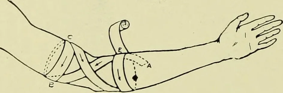 An illustration from Famous airmen and their equipment [electronic resource] : with some notes on first-aid in emergencies, 1912, leaf 75