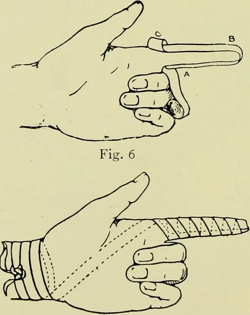 An illustration from Famous airmen and their equipment [electronic resource] : with some notes on first-aid in emergencies, 1912, leaf 75