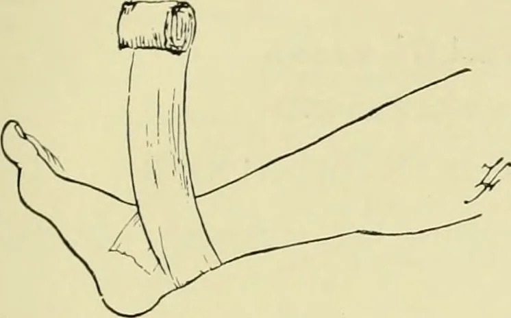 An illustration from Famous airmen and their equipment [electronic resource] : with some notes on first-aid in emergencies, 1912, leaf 76