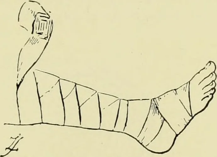 An illustration from Famous airmen and their equipment [electronic resource] : with some notes on first-aid in emergencies, 1912, leaf 76
