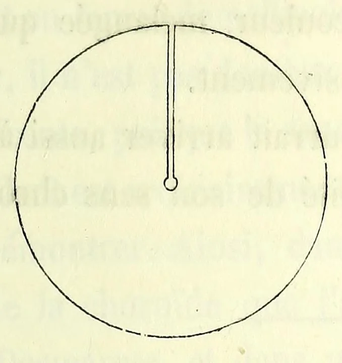 An illustration from Du diagnostic des maladies des yeux par la chromatoscopie rétinienne : précédé d'une étude sur les lois physiques et physiologiques des couleurs / par X. Galezowski, 1868, leaf 143