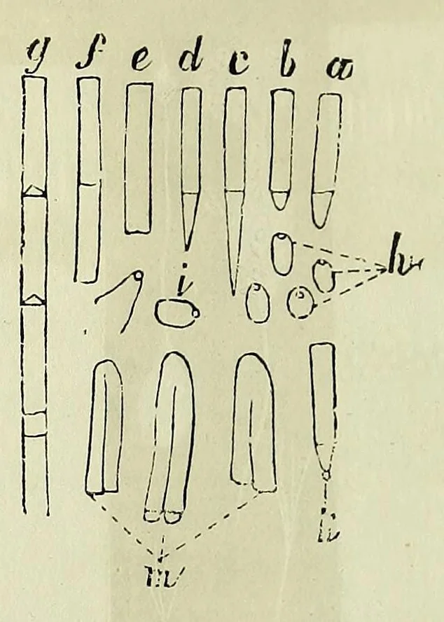 An illustration from Du diagnostic des maladies des yeux par la chromatoscopie rétinienne : précédé d'une étude sur les lois physiques et physiologiques des couleurs / par X. Galezowski, 1868, leaf 88