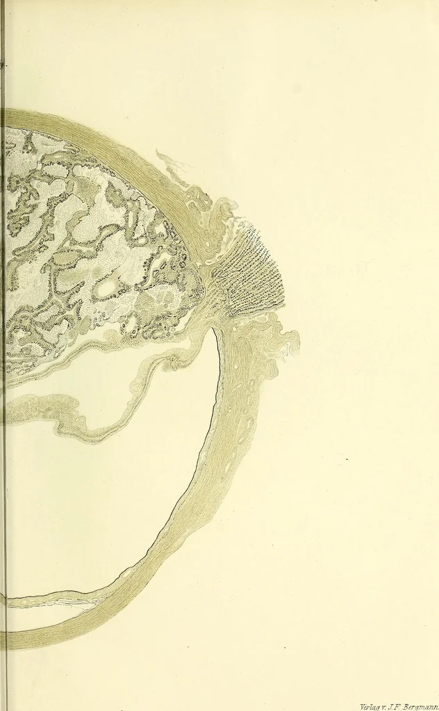 An illustration from Das Sarkom des Auges [electronic resource], 1900, leaf 305