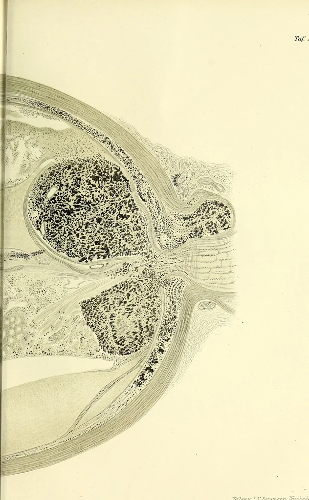 An illustration from Das Sarkom des Auges [electronic resource], 1900, leaf 317