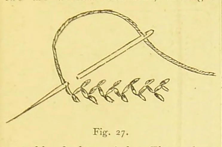 An illustration from The household oracle : a popular referee on subjects of household enquiry : including: - house building, buying and renting; house furnishing and decoration; housekeeping and domestic cookery; plain and fancy needlework; home farming, gardening, medicine; law; an epitome of the history of the world and the growth of the human family; the formation of our mother tongue and the rules of English grammar; a dictionary of religions; stepping stones of English history and a sketch of the English constitution setting forth the rights, privileges and duties of the English householder parochial, municipal, imperial; the story of the calendar, standards of weights and measures; arithmetical tables and tables of interest and a ready reckoner; household amusements, games, chess, cards and other indoor games, dancing, swimming, etiquette, ..., 1897, leaf 321