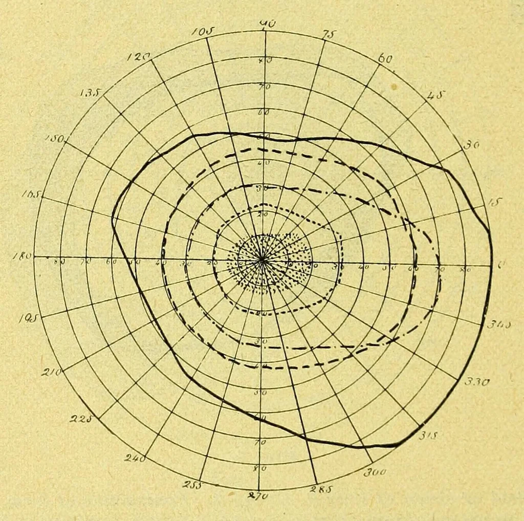 An illustration from Remarks on the field of vision in certain cases of "neglected eyes" / by G. E. de Schweinitz., 1895, leaf 10