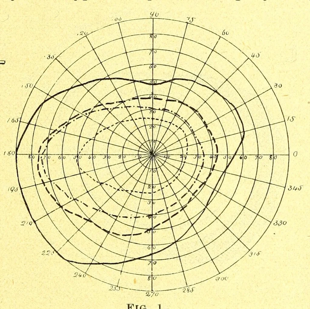 An illustration from Remarks on the field of vision in certain cases of "neglected eyes" / by G. E. de Schweinitz., 1895, leaf 5