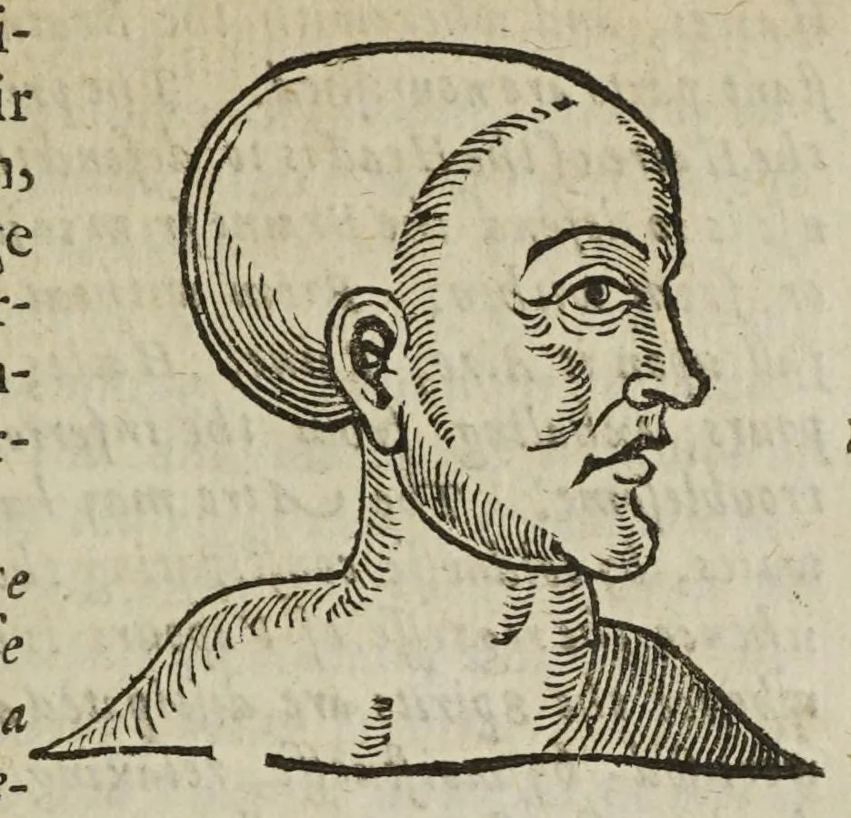 An illustration from Anthropometamorphosis: man transform'd; or, the artificial changeling. Historically presented, in the mad and cruel gallantry, foolish bravery, ridiculous beauty, filthy finenesse, and loathsome lovelinesse of most nations, fashioning and altering their bodies from the mould intended by nature. With a vindication of the regular beauty and honesty of nature. And an appendix of the pedigree of the English gallant, 1653, leaf 107