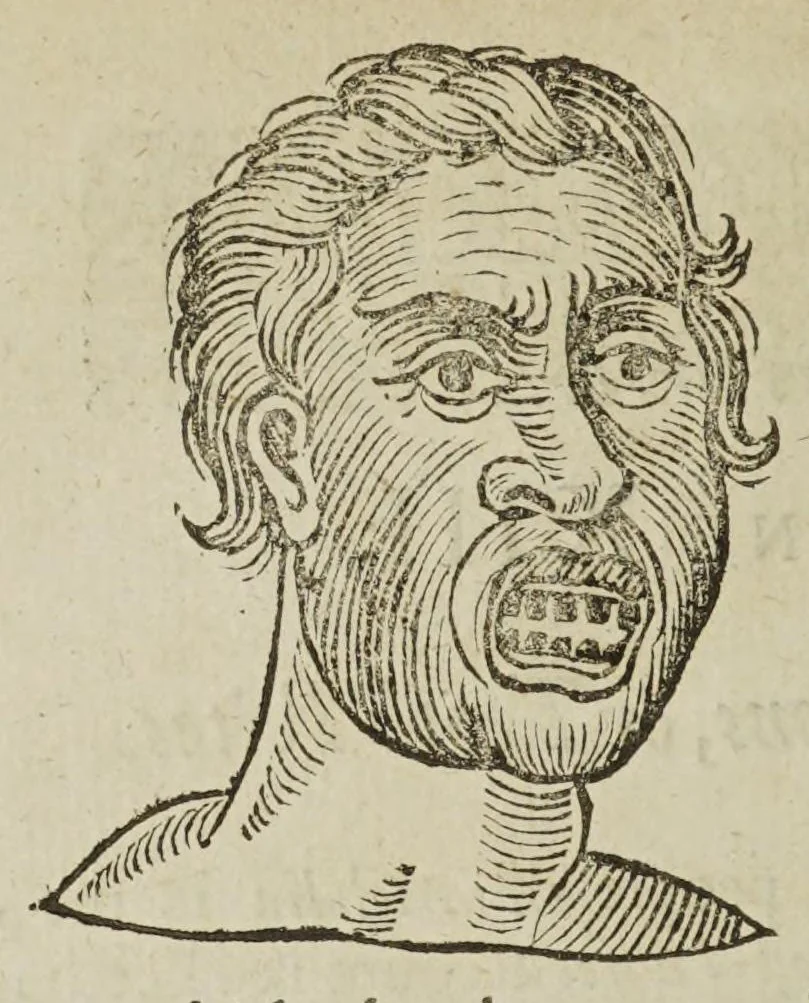 An illustration from Anthropometamorphosis: man transform'd; or, the artificial changeling. Historically presented, in the mad and cruel gallantry, foolish bravery, ridiculous beauty, filthy finenesse, and loathsome lovelinesse of most nations, fashioning and altering their bodies from the mould intended by nature. With a vindication of the regular beauty and honesty of nature. And an appendix of the pedigree of the English gallant, 1653, leaf 278