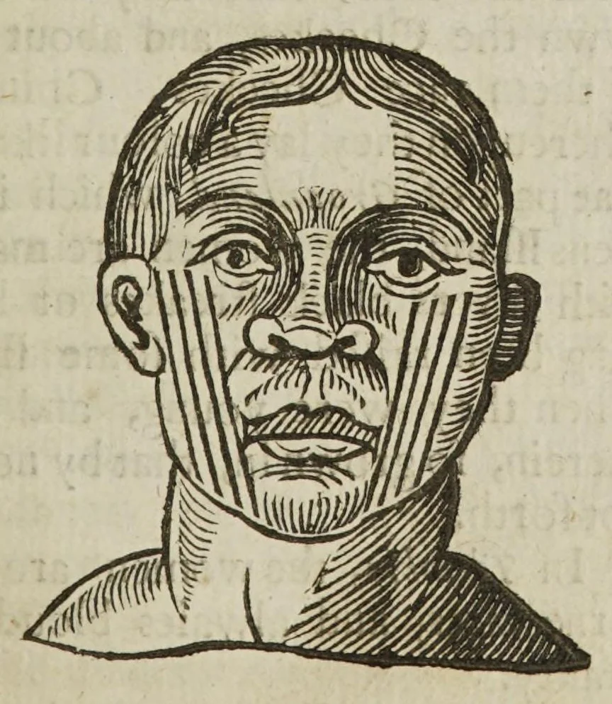 An illustration from Anthropometamorphosis: man transform'd; or, the artificial changeling. Historically presented, in the mad and cruel gallantry, foolish bravery, ridiculous beauty, filthy finenesse, and loathsome lovelinesse of most nations, fashioning and altering their bodies from the mould intended by nature. With a vindication of the regular beauty and honesty of nature. And an appendix of the pedigree of the English gallant, 1653, leaf 309