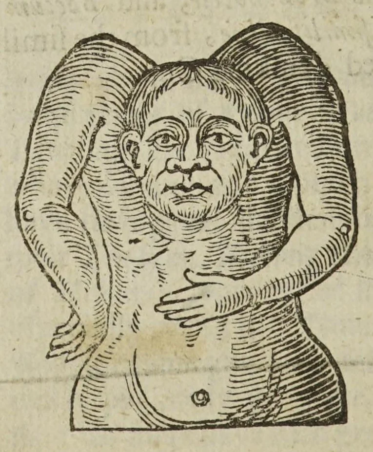 An illustration from Anthropometamorphosis: man transform'd; or, the artificial changeling. Historically presented, in the mad and cruel gallantry, foolish bravery, ridiculous beauty, filthy finenesse, and loathsome lovelinesse of most nations, fashioning and altering their bodies from the mould intended by nature. With a vindication of the regular beauty and honesty of nature. And an appendix of the pedigree of the English gallant, 1653, leaf 340