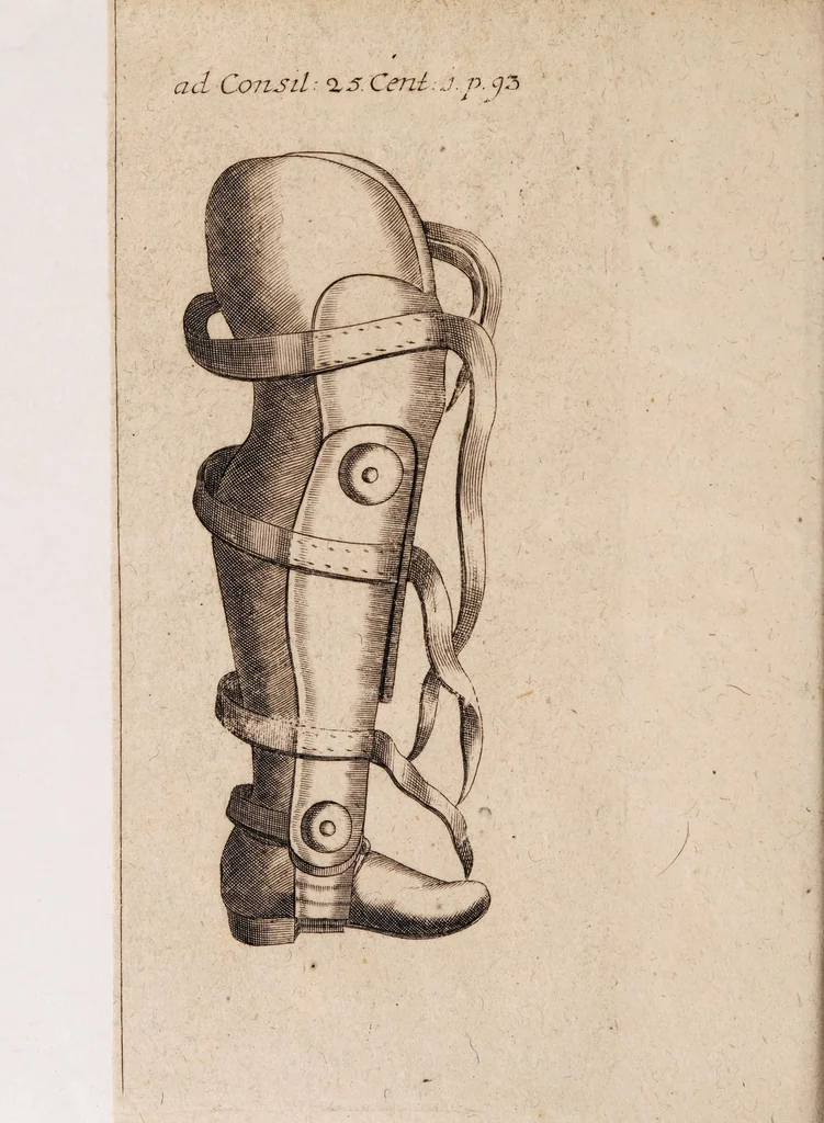 An illustration from Gallicinium medico-practicum. Sive consiliorum, observationum et curationum medicinalium novarum centuriae duae, cum dimidia ..., 1700, leaf 124
