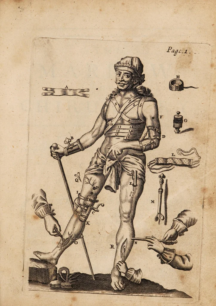 An illustration from Mellificium chirurgiae; or, the marrow of chirurgery. With the anatomy of human bodies according to the most modern anatomists, illustrated with many anatomical observations. Institutions of physick, with Hippocrates's aphorisms largely commented upon, The marrow of physick, shewing the causes, signs, and cures of most diseases incident to human bodies ..., 1700, leaf 23