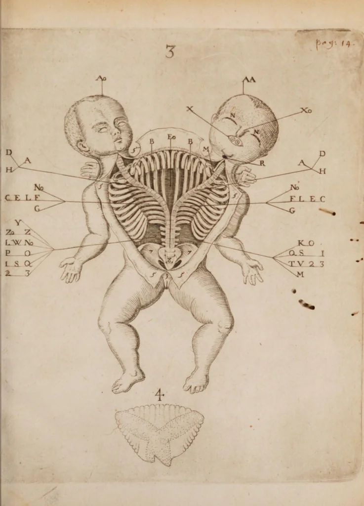 An illustration from Generosissimi, nobilissimi, expertissimique Di. Di. Ludovici de Bils à Copensdamme, Bonem, &c. Di. Urbis atque territorii Arbenburgici praetoris Specimina anatomica : cum clariss. doctissimorumque virorum epistolis aliquot & testimoniis., 1661, leaf 21