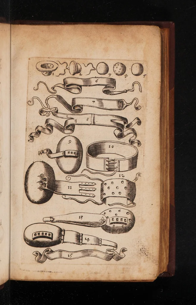 An illustration from De cauteriis libri quinque. In quibus vires, materia, modus, locus, numerus, tempus ponendorum cauteriorum, ex veterum Graecorum, Arabum, Latinorum, necnon neotericorum sententia quàm dilucidè explicantur, 1601, leaf 31
