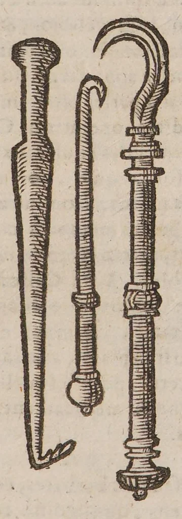 An illustration from La grande chirurgie de M. Guy de Chauliac, medecin tres fameux de l'Universite de Montpelier, composée l'an de grace mil trois cens soixante & trois, 1649, leaf 435
