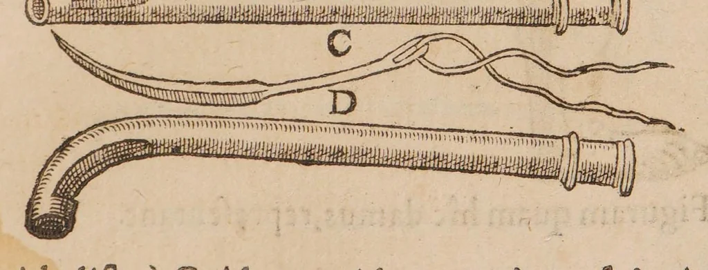 An illustration from Chirurgia magna, 1585, leaf 645