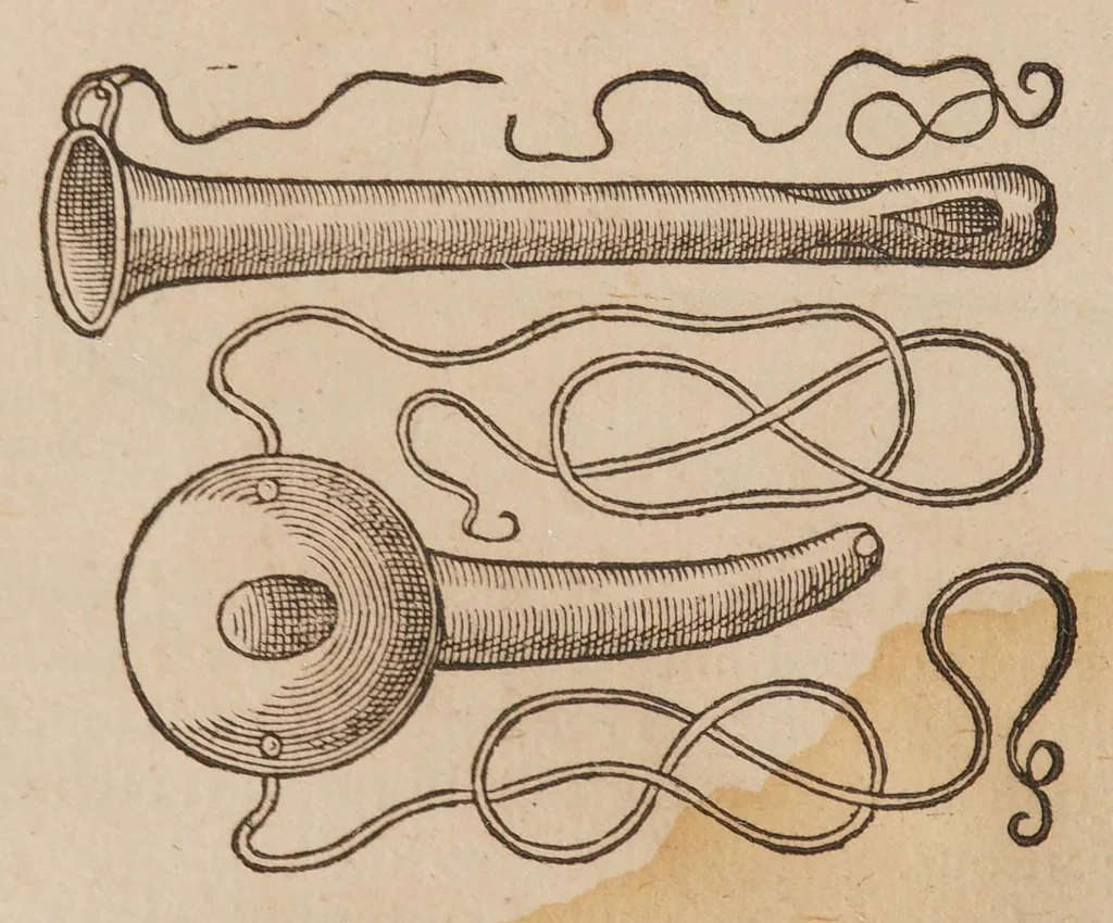 An illustration from Chirurgia magna, 1585, leaf 648