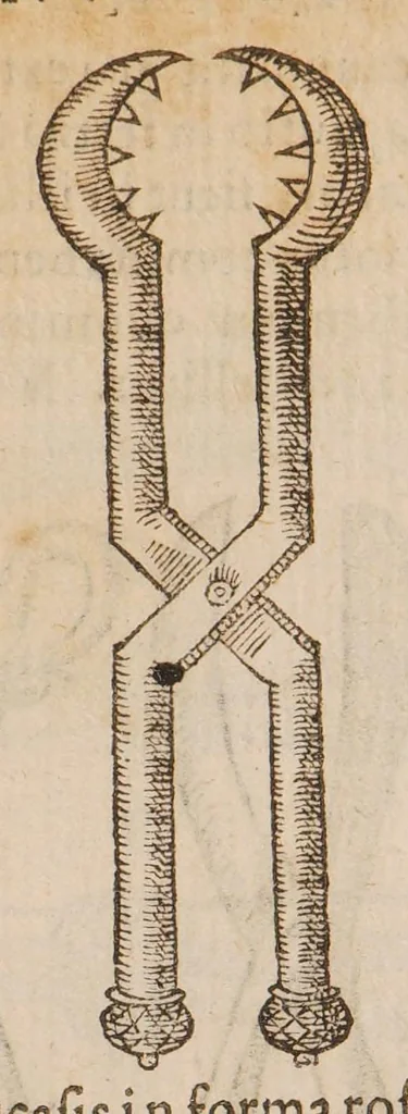 An illustration from Chirurgia magna, 1585, leaf 675