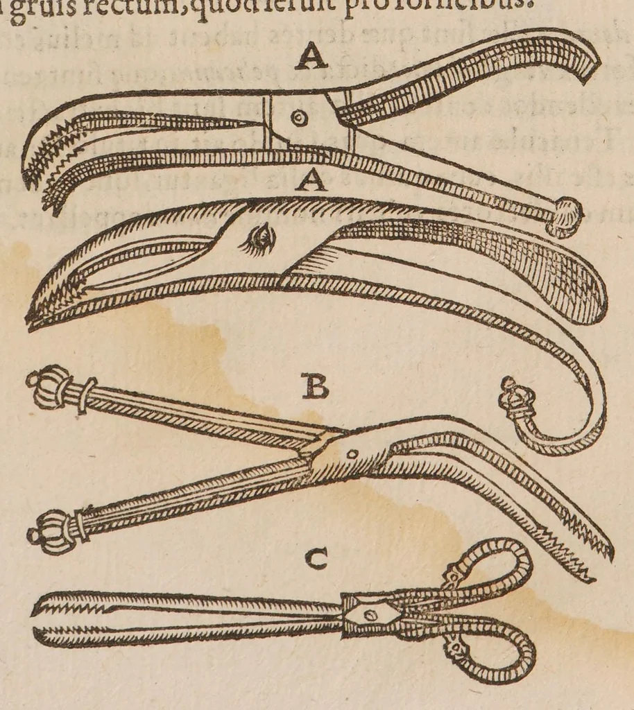 An illustration from Chirurgia magna, 1585, leaf 675
