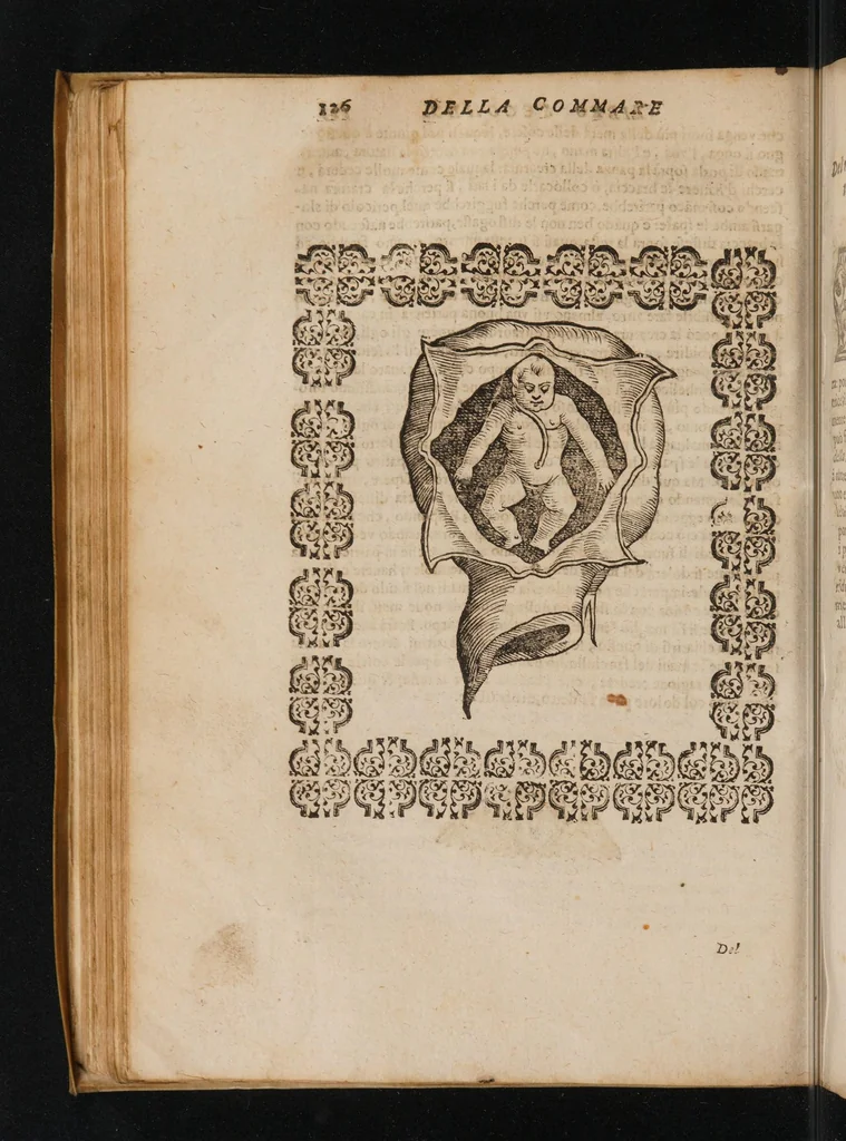 An illustration from La commare o raccoglitrice dell' eccellentissimo signor Scipion Mercurio ... divisa in tre libri, 1654, leaf 160