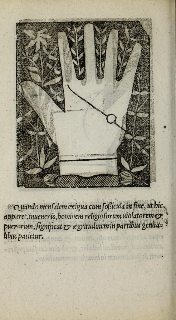 An illustration from Barptolomaei Coclitis bononiensis, naturalis philosophiae ac medicinae doctoris, Physiognomiae & chiromantiae compendium, 1533, leaf 202