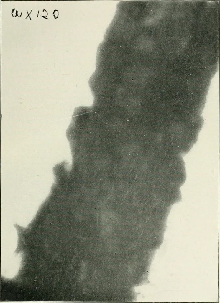 An illustration from Bibliotics; or, The study of documents; determination of the individual character of handwriting and detection of fraud and forgery. New methods of research, 1901, leaf 134