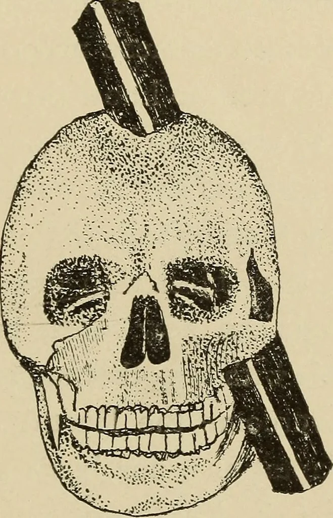 An illustration from Brain in relation to mind, 1899, leaf 52