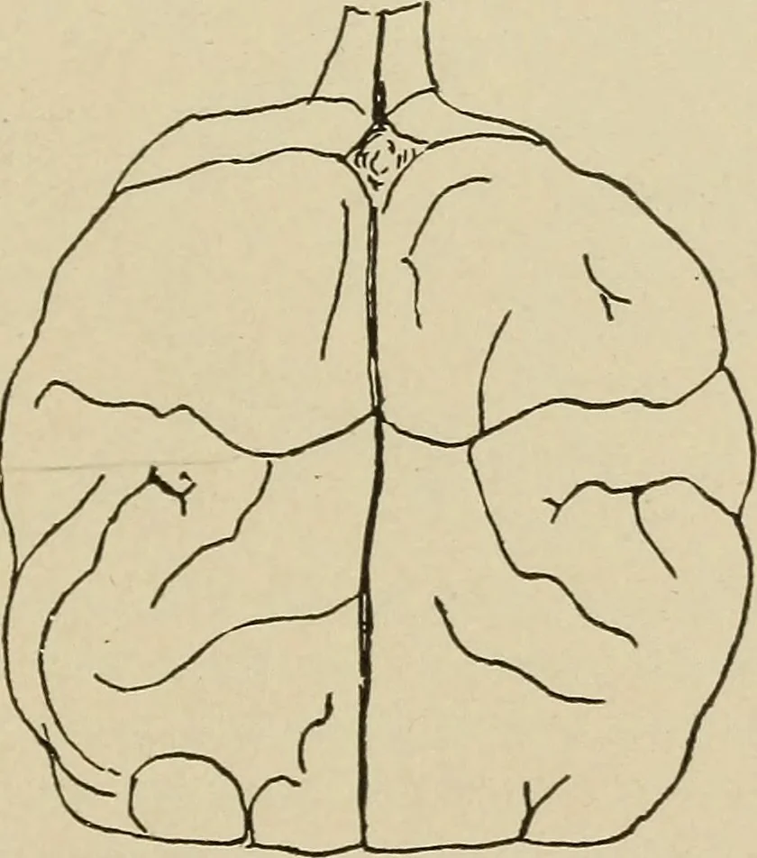 An illustration from Brain in relation to mind, 1899, leaf 54