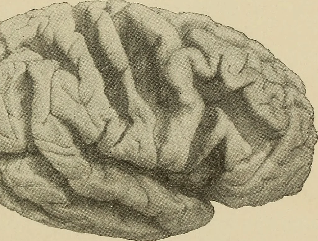 An illustration from Brain in relation to mind, 1899, leaf 72