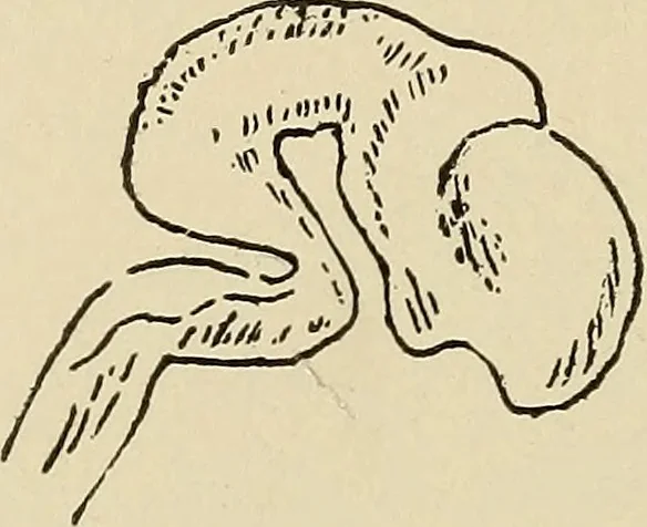 An illustration from Brain in relation to mind, 1899, leaf 73