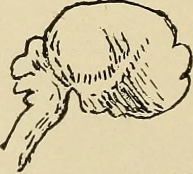 An illustration from Brain in relation to mind, 1899, leaf 73