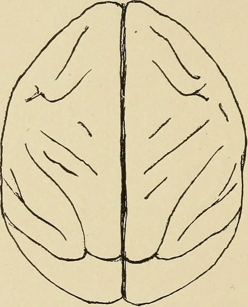 An illustration from Brain in relation to mind, 1899, leaf 75