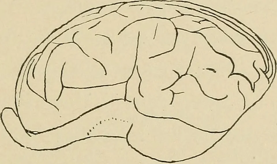 An illustration from Brain in relation to mind, 1899, leaf 76