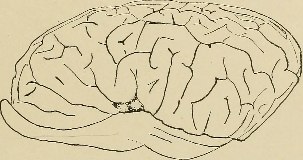 An illustration from Brain in relation to mind, 1899, leaf 76