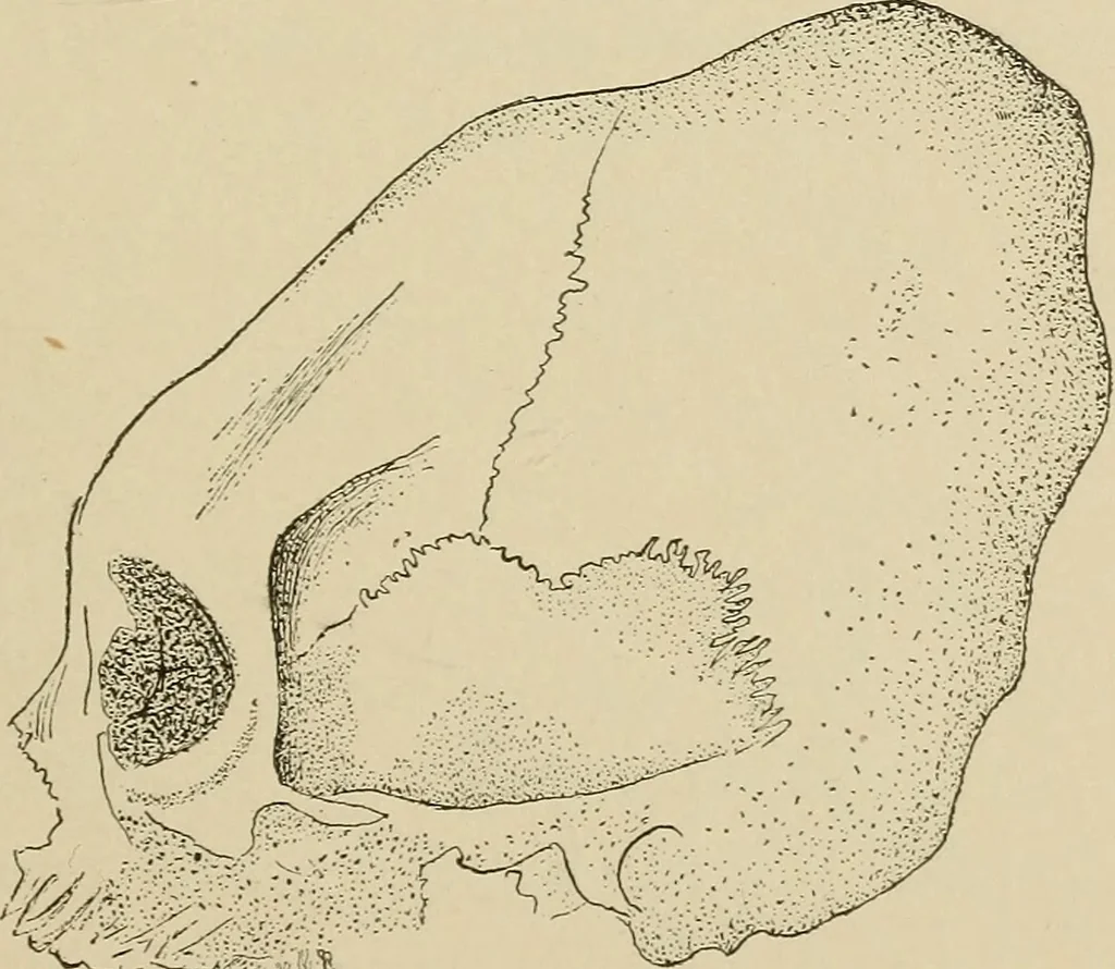 An illustration from Brain in relation to mind, 1899, leaf 92