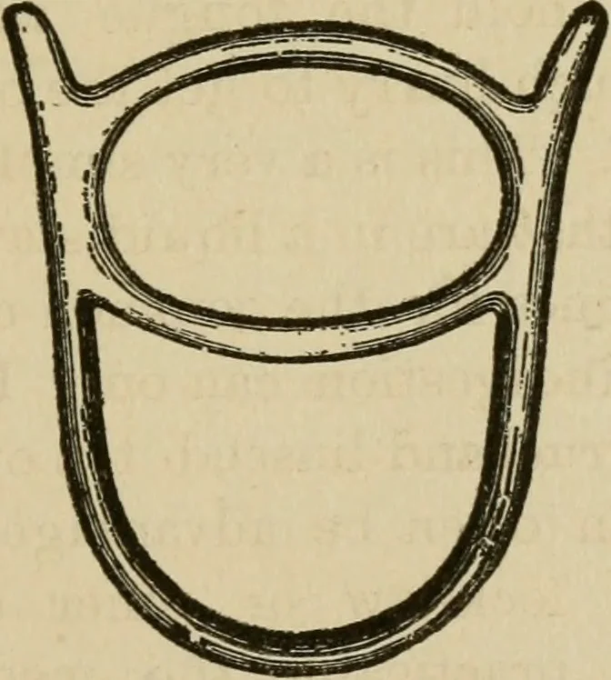 An illustration from Breeding, training, management and diseases of the horse and other domestic animals, 1893, leaf 200